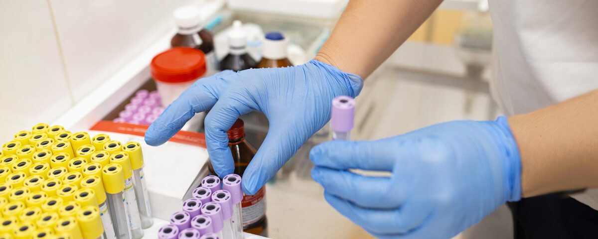 Many Boxes With Laboratory Test Tubes In The Clinic. A Laborator
